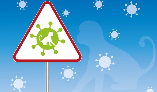22 cas de Variole du Singe ou Monkeypox confirmés en Occitanie