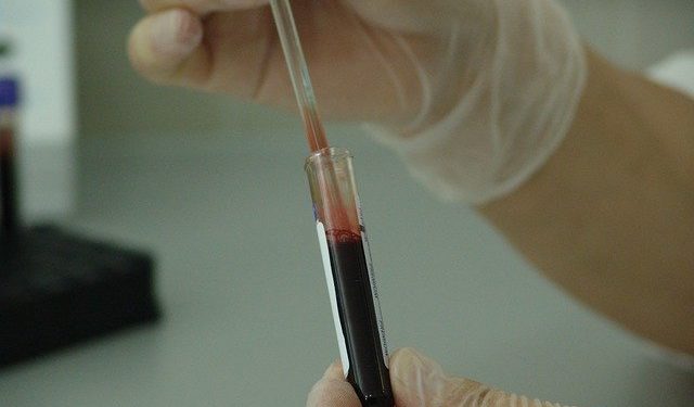 Près de la moitié des enfants positifs au VIH Sida bénéficient d'un traitement "salvateur"