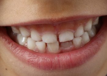 Les humains sont-ils les seuls à avoir des dents de lait ?