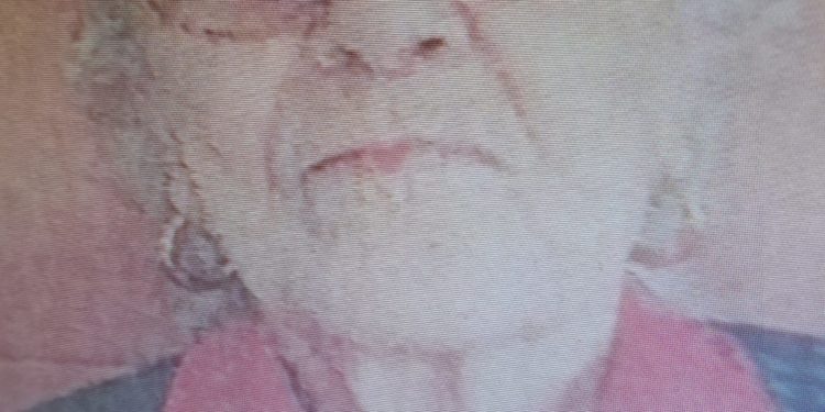 Disparition inquiétante d'une femme de 92 ans dans le Gers