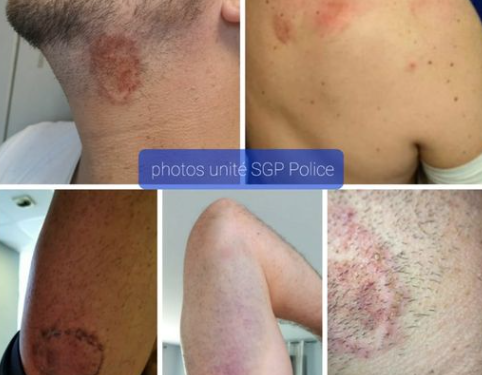 Tarbes - 4 policiers et 3 pompiers violemment agressés en intervention