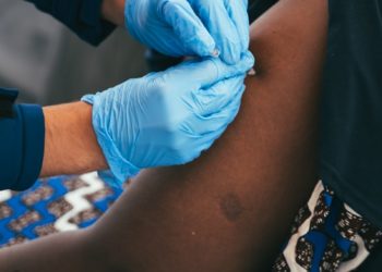 650 morts de la variole du singe Mpox en 2024 en République Démocratique du Congo, les vaccins européens arrivent